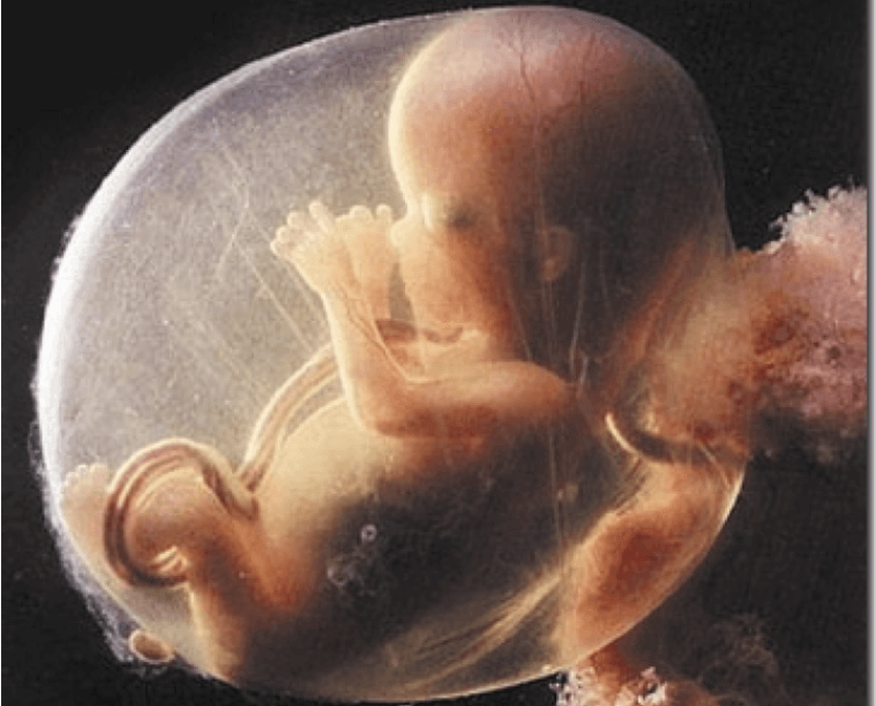 fetus