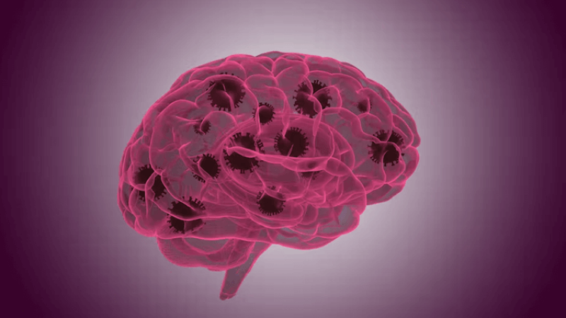 Severe COVID-19 causes aging-like changes in the human brain