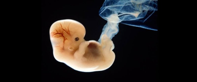 human embryo gty jt v x x