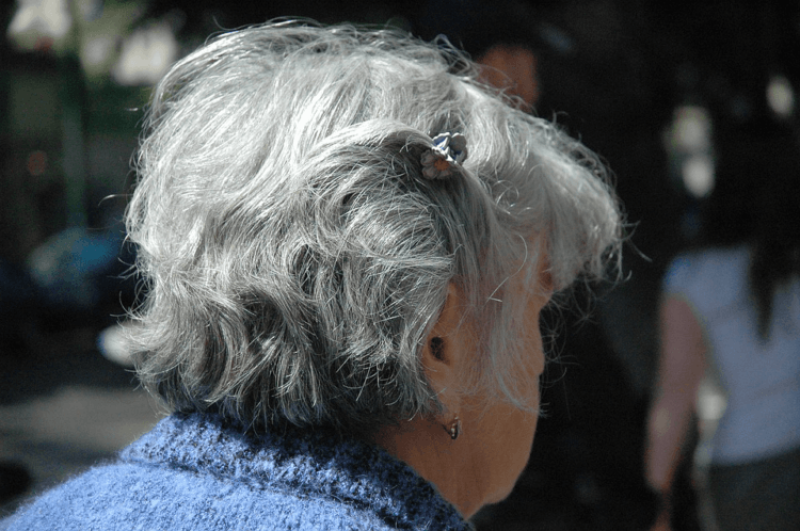 Why does hair turn silver with age? Discovering the root problem of graying
