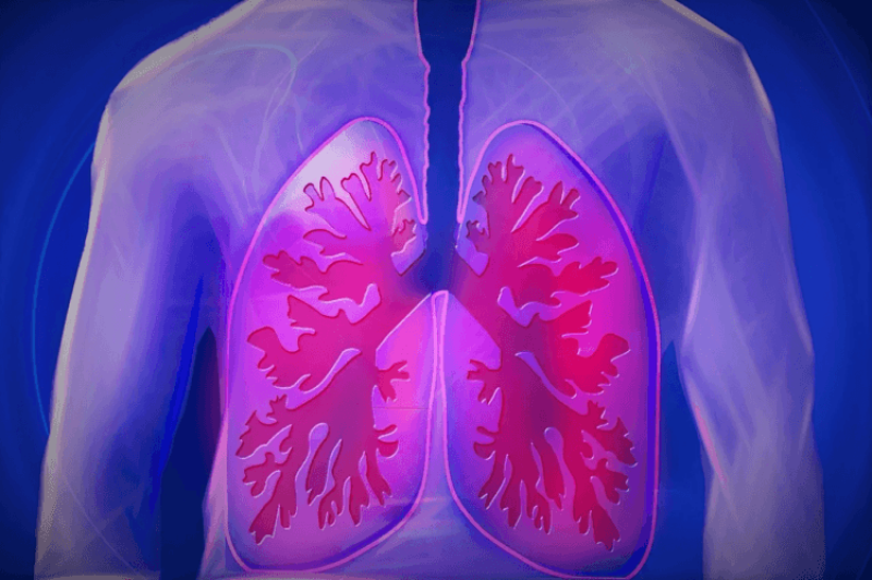 Dramatic visual evidence of how COVID decimates the lungs and causes long-term damage