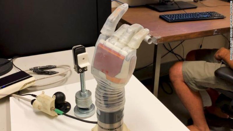 luke bionic arm exlarge