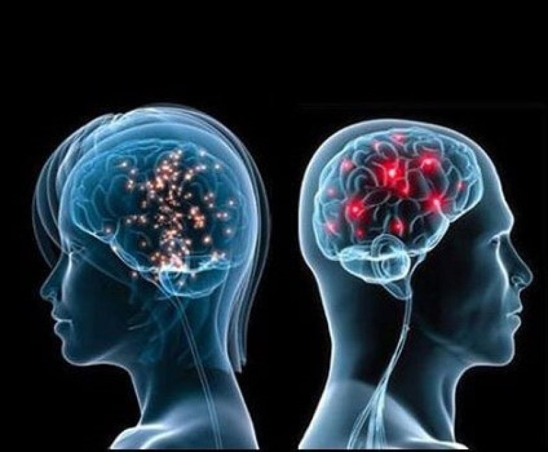 male vs female brain