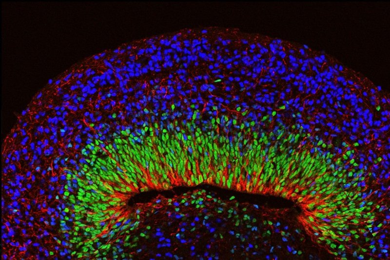 A microscope image of a mini brain organoid showing layered neural tissue and different types of neural cells. Credit: UCLA Broad Stem Cell Research Center/Nature Neuroscience