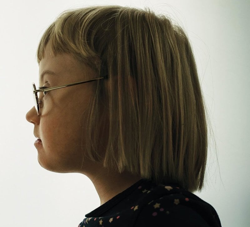 Sally Dybkjær Andersson, age 6, is one of very few children in Denmark with Down syndrome. Since universal prenatal screening was introduced in 2004, the number of children in the country born with the syndrome has fallen sharply. In 2019, it was just 18. Credit: Julia Sellmann