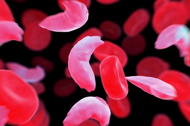 ui health validates cure for sickle cell in adults healthinnovations