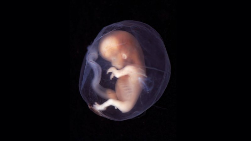 3-21-2019 week human embryo x
