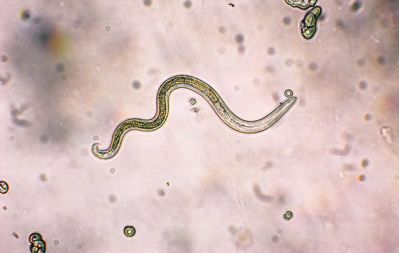 A roundworm that causes Toxocariasis under a microscope. Credit: dotana / Getty Images